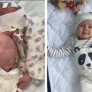 Olly Drury, now five months, was whisked away from his parents shortly after birth for resuscitation